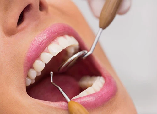 Teeth replacement care at Eagle Lake Family Dentistry